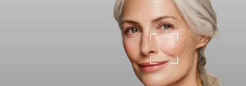Aging Skin
