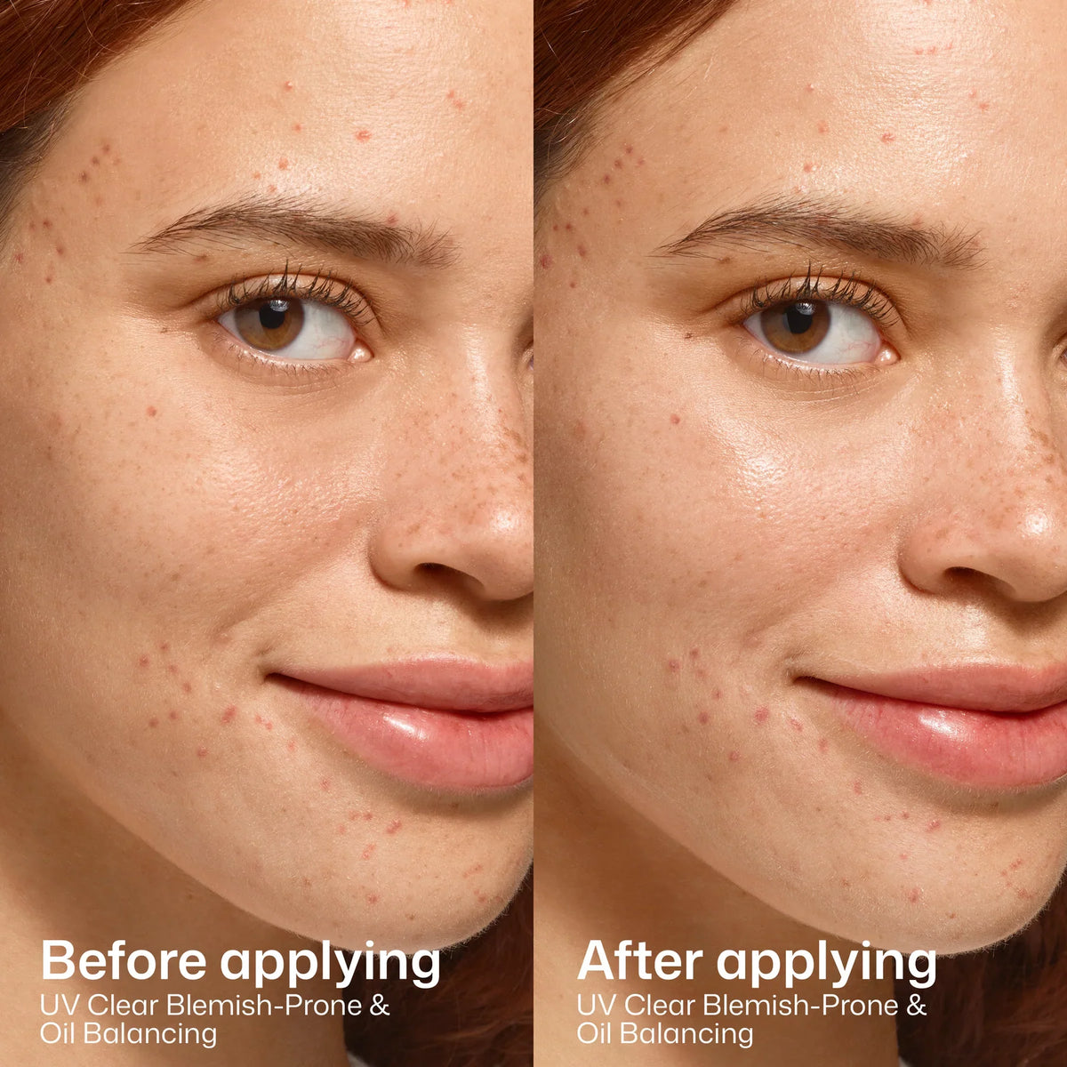 UV Clear Blemish-Prone & Oil Balancing SPF 50