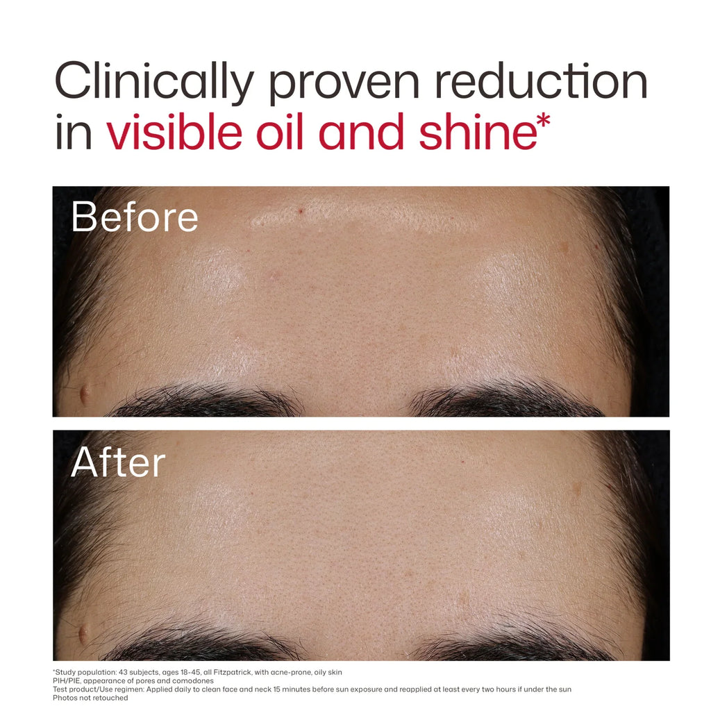 UV Clear Blemish-Prone & Oil Balancing SPF 50