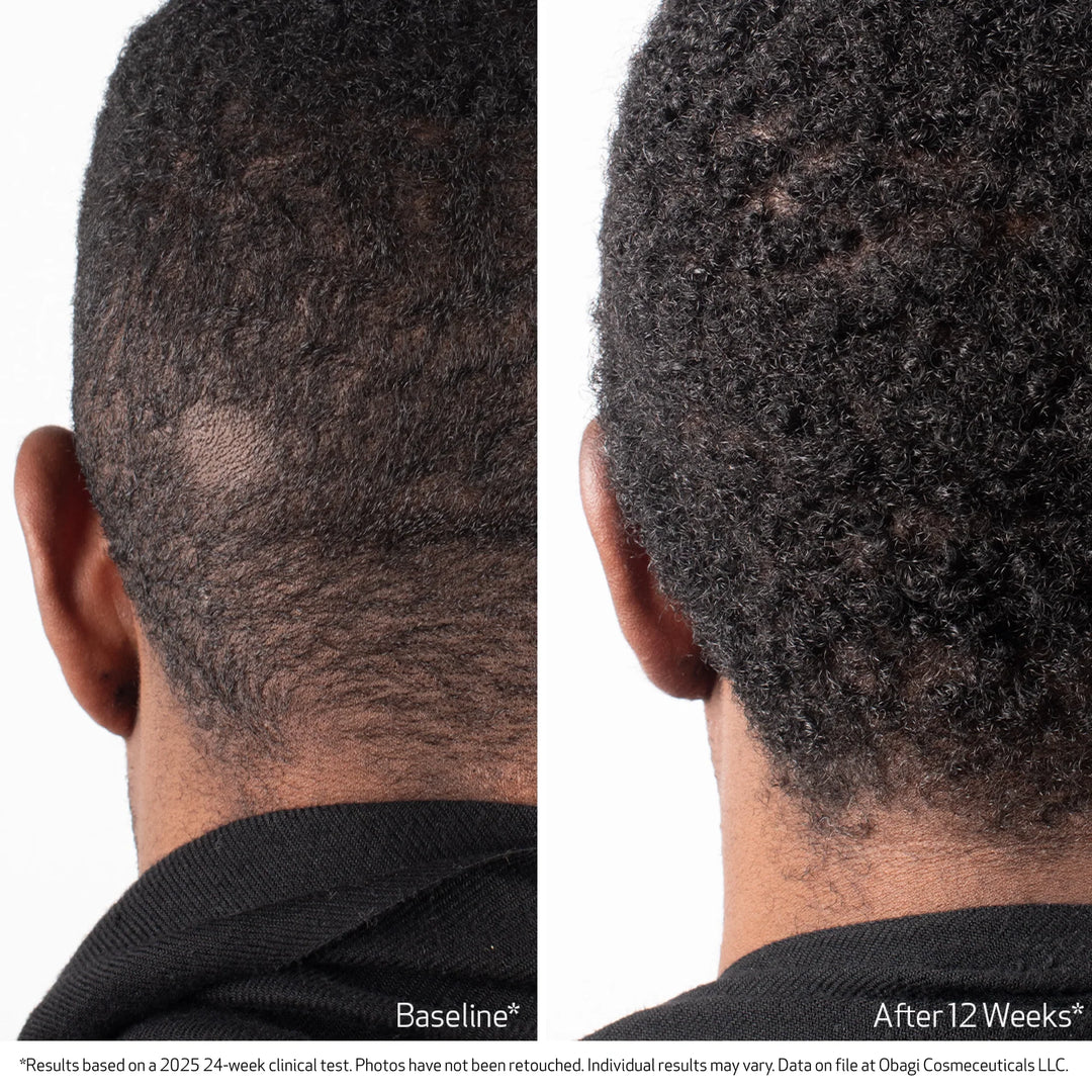 Obagi Nu-Cil BioStim Scalp Serum